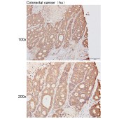 Solarbio K111474P Anti-BCAP31 Polyclonal Antibody