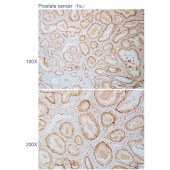 Solarbio K110842P Anti-ZNF148 Polyclonal Antibody