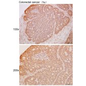 Solarbio K111732P Anti-MAPK8IP2 Polyclonal Antibody