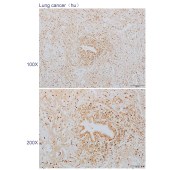 Solarbio K110583P Anti-SAMHD1 Polyclonal Antibody