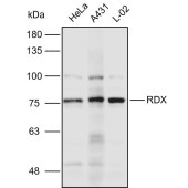 Solarbio K110936P Anti-RDX Polyclonal Antibody