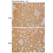 Solarbio K111404P Anti-ADAMTS4 Polyclonal Antibody