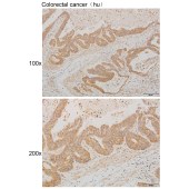 Solarbio K111244P Anti-ASGR1 Polyclonal Antibody