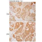 Solarbio K111795P Anti-GIMAP6 Polyclonal Antibody