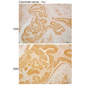 Solarbio K110533P Anti-NXT2 Polyclonal Antibody