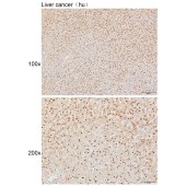 Solarbio K111641P Anti-RFC1 Polyclonal Antibody