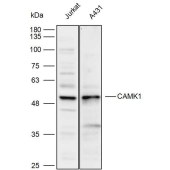 Solarbio K111861P Anti-CAMK1 Polyclonal Antibody