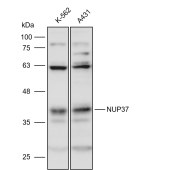 Solarbio K111610P Anti-NUP37 Polyclonal Antibody