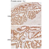 Solarbio K111289P Anti-PLG (heavy chain A short form, Cleaved-Val 98) Polyclonal Antibody