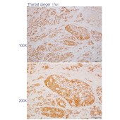 Solarbio K110610P Anti-AP3B1 Polyclonal Antibody