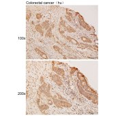 Solarbio K111863P Anti-KISS1R Polyclonal Antibody