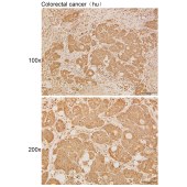 Solarbio K111882P Anti-IFI16 Polyclonal Antibody