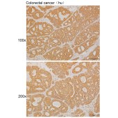 Solarbio K111307P Anti-ACO1 Polyclonal Antibody