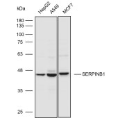 Solarbio K110593P Anti-SERPINB1 Polyclonal Antibody