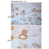 Solarbio K111088P Anti-IKBKB Polyclonal Antibody