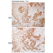 Solarbio K111949P Anti-SSNA1 Polyclonal Antibody