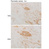 Solarbio K111914P Anti-HKDC1 Polyclonal Antibody