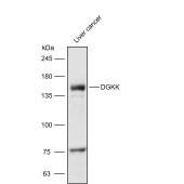 Solarbio K111642P Anti-DGKK Polyclonal Antibody