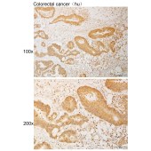 Solarbio K111111P Anti-SEMA3A Polyclonal Antibody