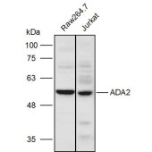 Solarbio K110993P Anti-ADA2 Polyclonal Antibody