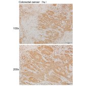 Solarbio K111893P Anti-FCSK Polyclonal Antibody