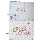 Solarbio K110930P Anti-ZSCAN21 Polyclonal Antibody
