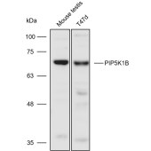 Solarbio K110606P Anti-PIP5K1B Polyclonal Antibody