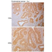 Solarbio K111008P Anti-SPART Polyclonal Antibody