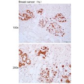 Solarbio K111645P Anti-SERPINA7 Polyclonal Antibody