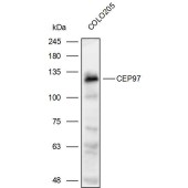 Solarbio K111983P Anti-CEP97 Polyclonal Antibody