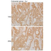 Solarbio K111898P Anti-STARD13 Polyclonal Antibody