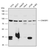 Solarbio K111072P Anti-CNKSR1 Polyclonal Antibody