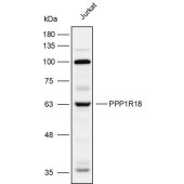 Solarbio K111945P Anti-PPP1R18 Polyclonal Antibody