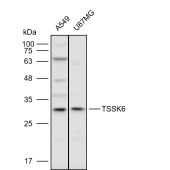 Solarbio K111603P Anti-TSSK6 Polyclonal Antibody