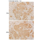 Solarbio K111913P Anti-MYO10 Polyclonal Antibody