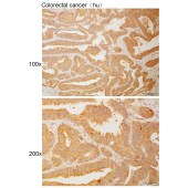 Solarbio K110945P Anti-FCHO2 Polyclonal Antibody