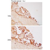 Solarbio K112107P Anti-TICAM2 Polyclonal Antibody