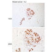 Solarbio K110931P Anti-CLINT1 Polyclonal Antibody