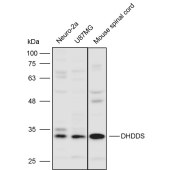 Solarbio K111607P Anti-DHDDS Polyclonal Antibody