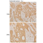 Solarbio K111891P Anti-NFATC3 Polyclonal Antibody