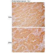 Solarbio K112096P Anti-USP32 Polyclonal Antibody