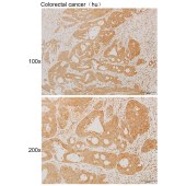 Solarbio K111926P Anti-PAGE4 Polyclonal Antibody