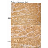 Solarbio K111872P Anti-ZNF596 Polyclonal Antibody