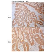 Solarbio K110969P Anti-CHMP4A Polyclonal Antibody
