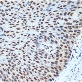 Solarbio K009915M Anti-Histone H2B Monoclonal Antibody