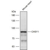Solarbio K111492P Anti-CHSY1 Polyclonal Antibody