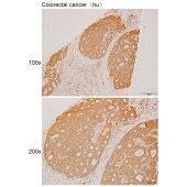 Solarbio K111455P Anti-CSMD2 Polyclonal Antibody