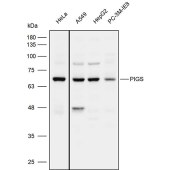 Solarbio K111781P Anti-PIGS Polyclonal Antibody