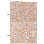 Solarbio K110949P Anti-DTX3L Polyclonal Antibody