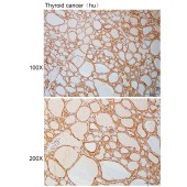 Solarbio K110926P Anti-NDUFA4L2 Polyclonal Antibody